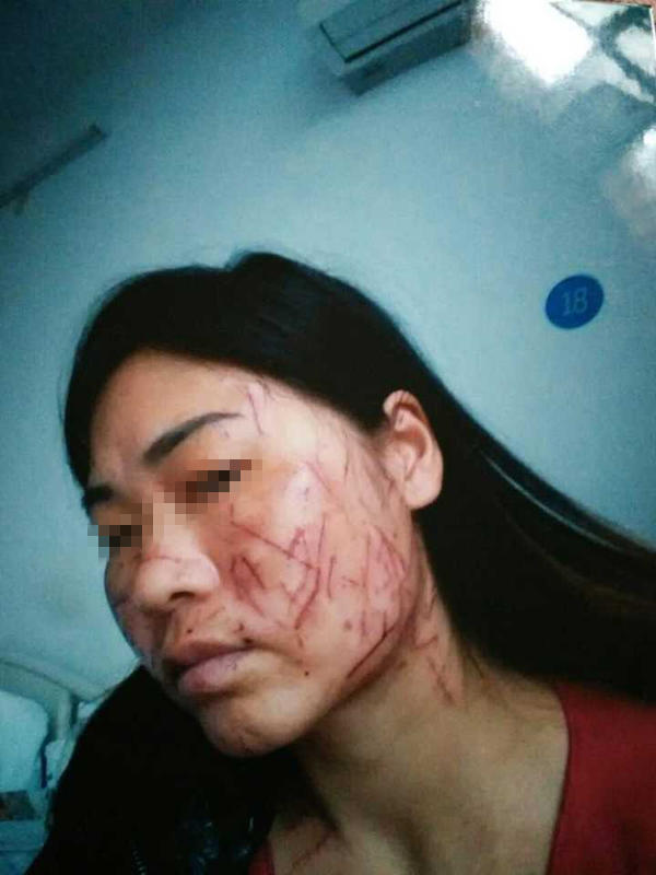 1470971043978757.jpg W020160812094080022145.jpg